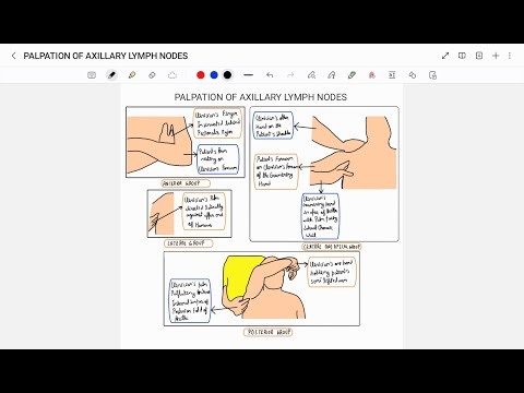 EXAMINATION OF AXILLARY LYMPH NODES