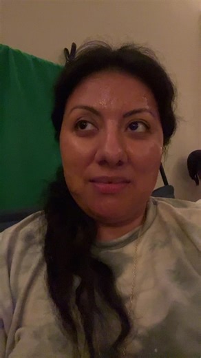 Dealing with a Cavity on Front Teeth: What You Need to Know