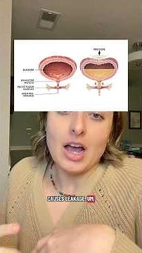 Explaining the different types of incontinence