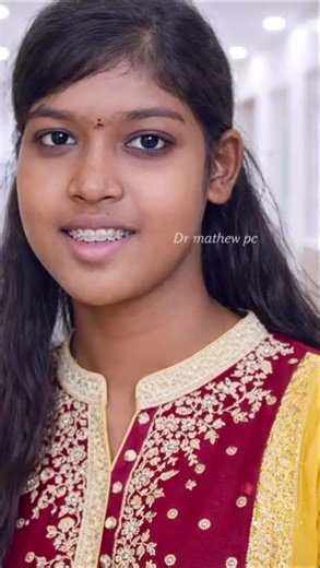 Complete Facial Transformation Case | Total Joint Replacement & Orthognathic Surgery | Dr Mathew PC