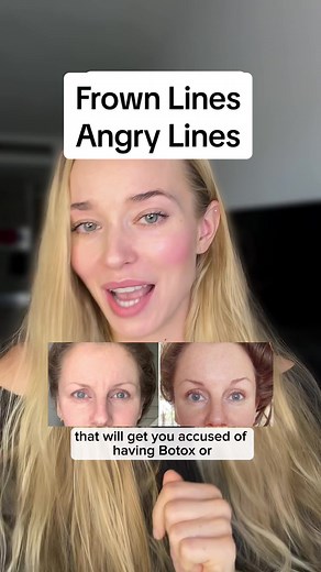 Lift Brows & Erase Frown Lines: Face Massage Tutorial