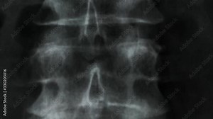 X-ray of the bones of the human vertebral column and pelvis, 4K