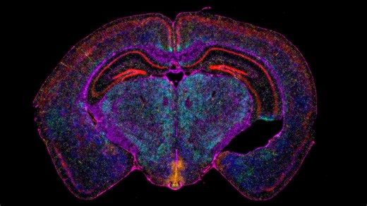 How Lunaphore's HORIZON™ software transforms spatial biology data | Bio-Techne posted on the topic | LinkedIn