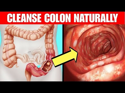 7 Natural Tricks To Cleanse Your Colon and Boost Your Health