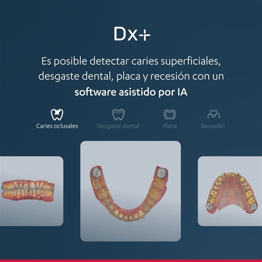 Aprende a mejorar la comprensión del paciente con el software de diagnóstico asistido por IA 3Shape TRIOS Dx Plus y TRIOS MOVE Pro. | 3Shape Iberia
