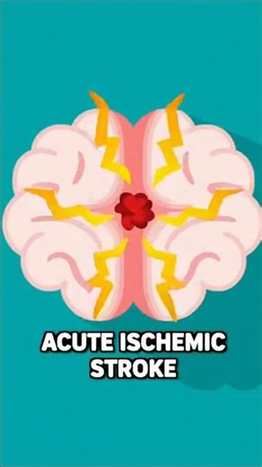 Study details in description!