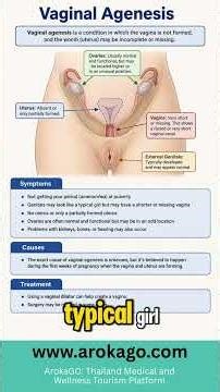 Vaginal Agenesis: Symptoms, Causes & Treatment Options Explained