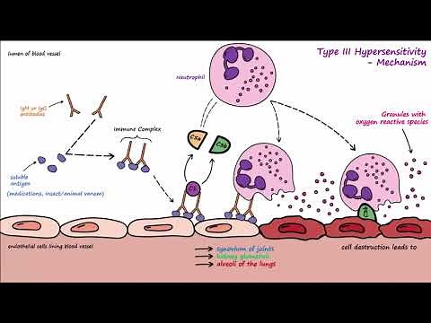 Type III Hypersensitivity