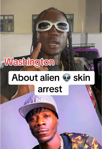 Alien Skin Arrest: Latest Updates from Uganda