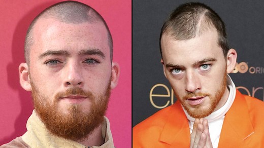 Euphoria's Angus Cloud reveals how he got the scar on his head