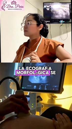 Ecografía morfológica en el embarazo: qué evalúa y cuándo hacerla