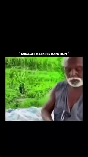 Know In Minutes ✨ on Instagram: "This video is a perfect example of how viral content often plays with perception rather than science. The phrase “miracle hair restoration” paired with lush green visuals creates an illusion of instant regrowth, but in reality, human hair follicles don’t work like farmland that suddenly turns green overnight. Scientifically, hair growth is a slow biological cycle influenced by genetics, hormones, nutrition, scalp health, and time—there is no proven method that ca