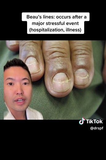 Understanding Nail Health: What Your Nails Can Reveal About Your Overall Health