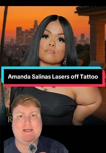 Amanda Salinas lasers off signature paw print tattoo
