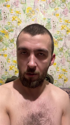 Understanding Double Jointedness: A Unique Perspective