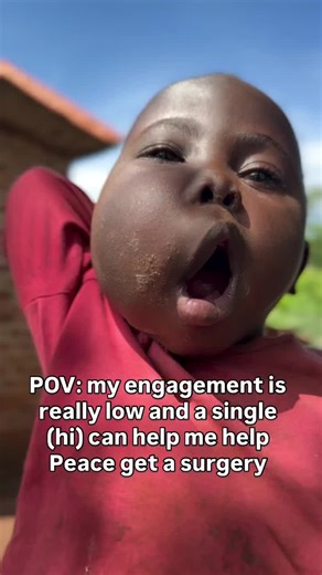 Sometimes it doesn’t take money, fame, or big actions to save a life… A simple “hi” can help Peace reach more people and get the surgery she urgently needs 🤍🙏 Please stop for a few seconds, comment anything, share this post, or even watch till the end. Your small action helps boost engagement and brings her closer to the help she needs. Peace is fighting, and she deserves a chance to heal, smile, and live without pain. If you’re seeing this, it’s not by accident. Be her voice today. Even one w