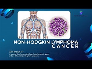 Non-Hodgkin Lymphoma Explained: Symptoms, Causes & Early Warning Signs
