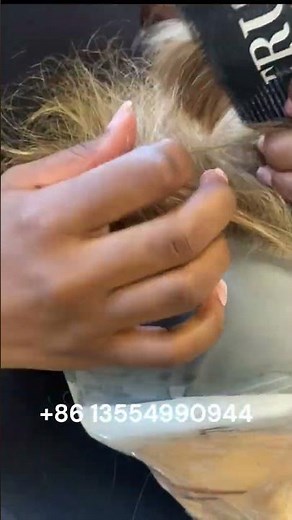 Hair injection machine #ventilation #hairinjectmachine