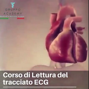 Corso di Interpretazione Tracciato ECG 磊 Certificato Clicca qui per info e iscrizioni: https://www.gruppoacademy.com/prodotto/tracciato-ecg/ ✅ Per Sanitari e Personale di Assistenza ✅ Interpreta un Tracciato ECG semplice e complesso ✅ Svolgilo senza limite di Tempo ed ottieni il Certificato | Medical Academy | Facebook