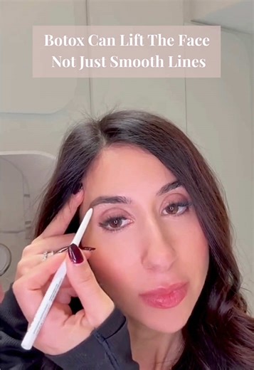 Botox doesn’t just smooth lines — it can lift the face when placed with strategy and precision. ✨ Here are the key injection points that create a natural, upward lift without adding volume. 1️⃣ Brow Lift: Strategic Botox relaxes the muscles that pull the brows downward, allowing the brows to open and the eyes to look more awake. 2️⃣ DAO (Depressor Anguli Oris): A tiny drop here lifts the corners of the mouth, softens a “downturned” expression, and brightens the entire lower face. 4️⃣ Neck / Jawl