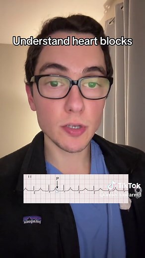 Understanding Heart Block: Types and Identification