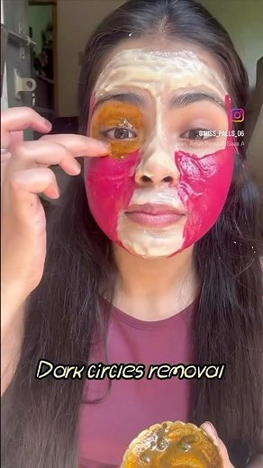 dark circles under eyes home remedy,✨💯 #ytshorts #diy #beauty #skincare #darkcircles #viral