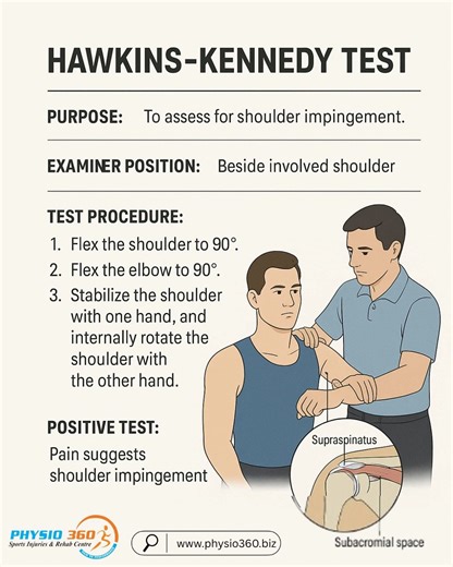 How to perform the Hawkins-Kennedy Test for shoulder impingement | Physio360Chennai posted on the topic | LinkedIn