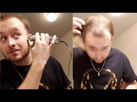 BALDING AT 20 - Going Bald And Shaving My Head for good