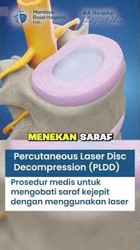 Operasi Saraf Kejepit Dengan Metode PLDD, Radiofrekuensi & ACDF | dr, Christian Permana, Sp.BS F-NTB