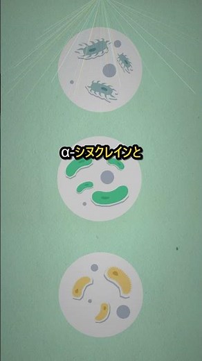パーキンソン病の本当の原因、知ってた？