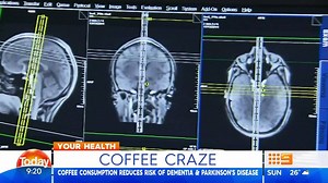 100K views · 601 reactions | ATTENTION COFFEE LOVERS: We all know coffee is good for getting up in the morning, but did you know its also good for your brain? #9Today | TODAY | Facebook