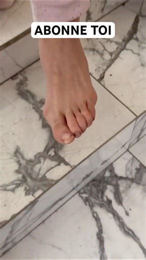 Les pieds de Assia 🤢🤮 #nasdas