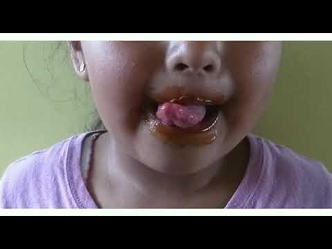 Ejercicios orofaciales