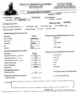 Understanding Your Semen Analysis - Eric Tygenhof, M.D. F.A.C.S.