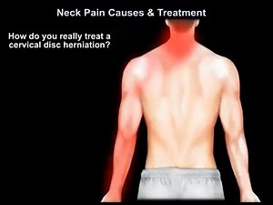 Neck Pain Causes, symptoms, diagnosis and Treatment