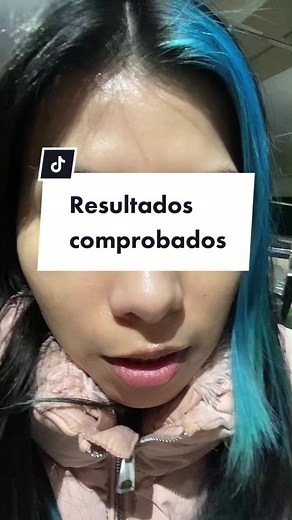 #pegar un video de @karli_tpc Borró todo. #acne #skincaretips