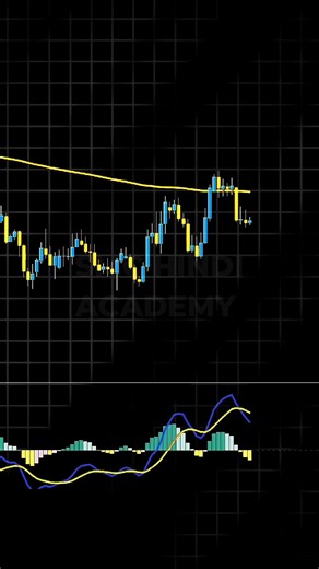 MACD Trading Strategy Hindi Stock Market #trading #forextrading #stockmarket