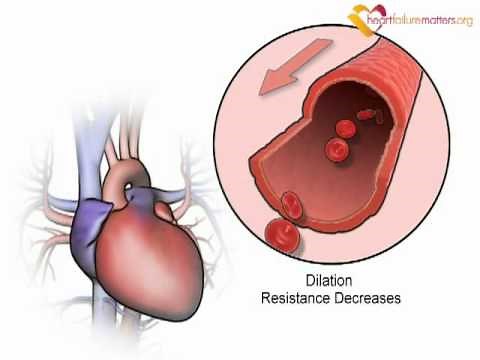 How vasodilators work in heart failure - www.heartfailurematters.org