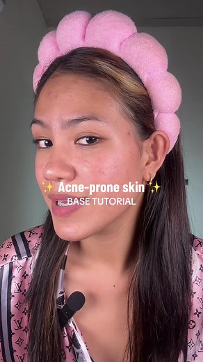 Acne Prone Skin Base Makeup Tutorial