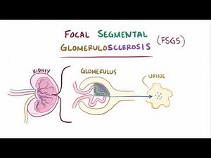 Focal segmental glomerulosclerosis causes, symptoms, diagnosis & pathology
