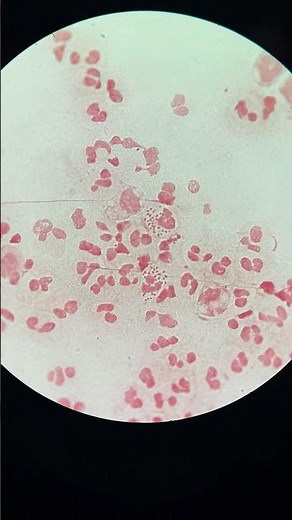 Tinción de gram, exudado uretral #bacteriologia #microbiology #microbiología