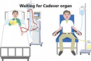 Potential cadaver organ causing event tracking on Blockchain