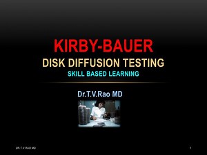 PPT - Kirby-Bauer Antibacterial Sensitivity testing PowerPoint Presentation - ID:288039