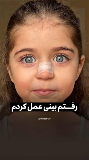 ‎گندم🌾‎ on Instagram‎: "⁨ اینم نتیجه عمل بینی خواهرشوهرم😍 فقط اونجا که فهمید فیلمه گفت زن داداشمو دوست دارم🤣 ولی هیچی اندازه یه بینی شیک و زیبا و بی نقص نمیتونه روی چهره تاثیرگذار باشه👌🏼قبول دارید؟ و مرسی از لوندر پارک ‪@lavenderpark.centerr‬‪@lavenderpark.centerr‬rr که از هر لحاظ درجه یک هستن و بعد از کلی تحقیق به خواهرشوهر جان معرفیشون کردم و راضی ترینیم👌🏼 #جراحی_بینی#عمل_بینی#رینوپلاستی⁩"‎