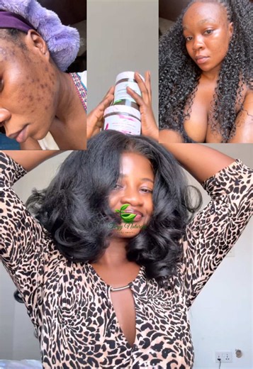 Natural Fairness with African Black Soap: Tips for Healthy Skin