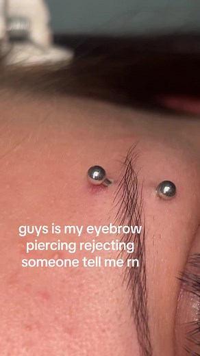 Understanding Eyebrow Piercing Rejection Symptoms