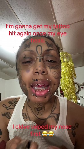 Managing Blepharitis in Your Left Eye: Tips and Insights