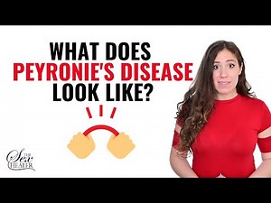 What Does Peyronie's Disease Look Like? [WHY IS IT CROOKED]?