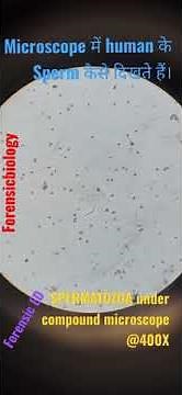 SEMINAL FLUID EXAMINATION: PRACTICAL