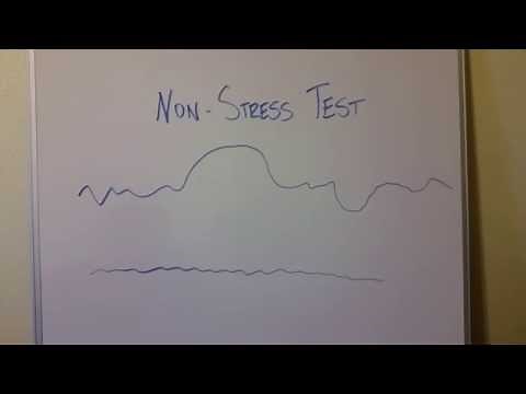 Non-Stress Test for Pregnant Moms